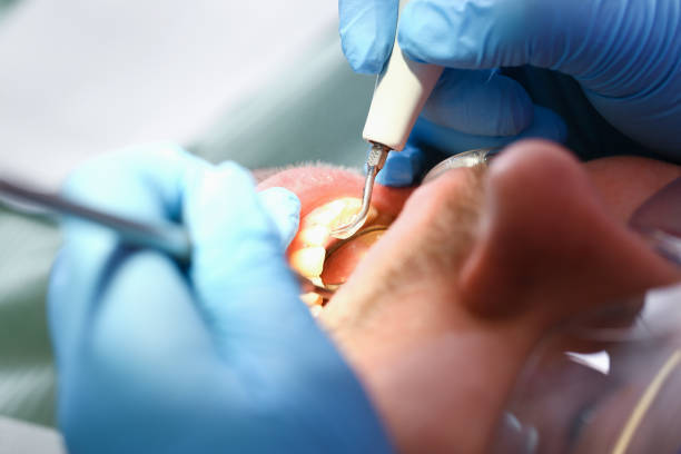  Asheville, NC Emergency Dentist Pros